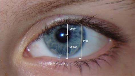 Ophthalmic Measurements 